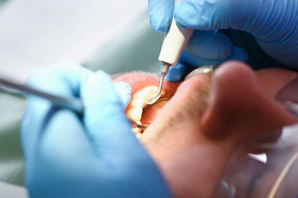 Best After-Hours Emergency Dentist in Manvel, TX